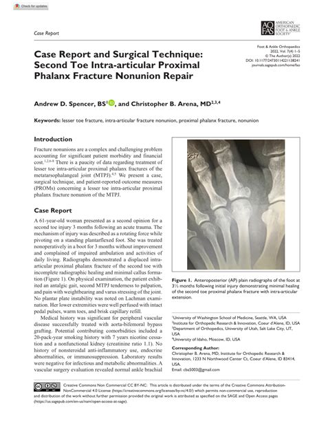 (PDF) Case Report and Surgical Technique: Second Toe Intra-articular ...