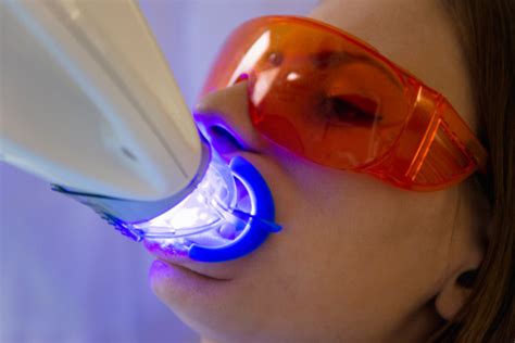 Laser Teeth Whitening Stock Photo - Download Image Now - iStock