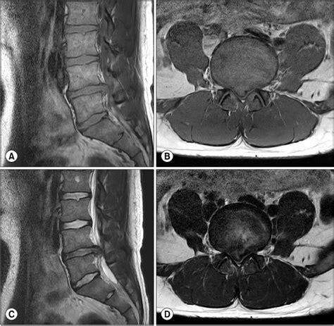 [DIAGRAM] Pulse Diagram Mri - MYDIAGRAM.ONLINE