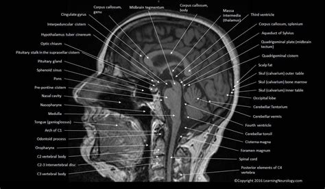 Mri Anatomy Of Brain - ANATOMY