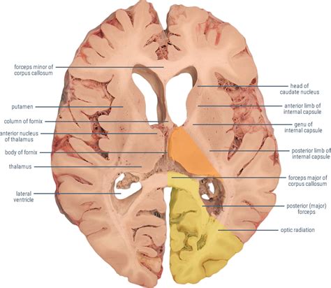 Posterior Cerebral Artery