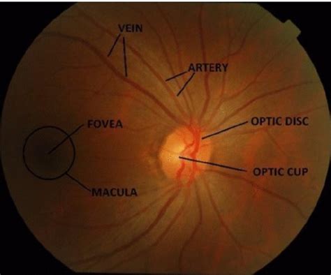 Represents the various eye feature used in glaucoma detection for a ...