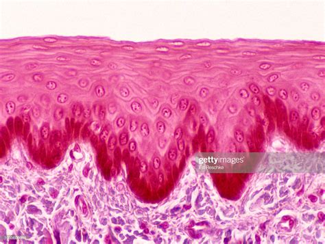 ストックフォト : Epithelium--STRATIFIED SQUAMOUS EPITHELIUM lining the ESOPHAGUS, 100x Stratified ...