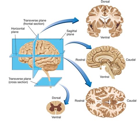 Transverse Plane Brain