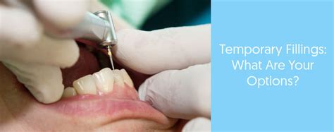 What Are Your Temporary Dental Filling Options? | Dental Aware Australia