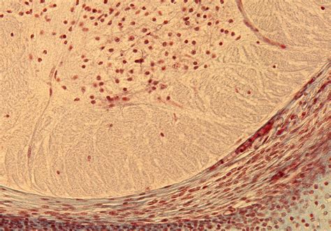 Tissue 141 – Ventral Horn in Thoracic Region