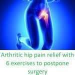 Arthritic hip pain relief with 6 exercises to postpone surgery