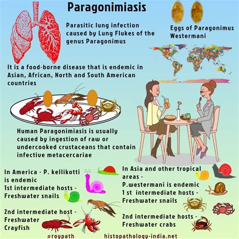 Pathology of Paragonimiasis (Lung Fluke) #roypath | Pathology, Nursing ...