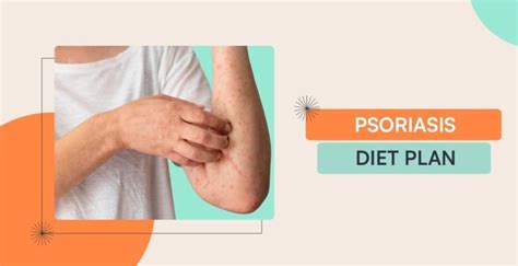 Psoriasis Diet Plan: A Basic Sample Meal For Psoriasis Patients