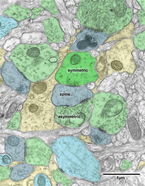 Chapter 9 – synapses » Fine Structure of the Aging Brain | Boston University