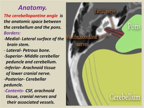 Presentation1.pptx, radiological imaging of cerebello pontine angle mass lesions.