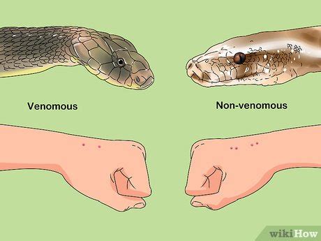 3 Ways to Treat a Snake Bite - wikiHow