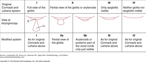 Cormack-Lehane Grading Examples | OpenAirway