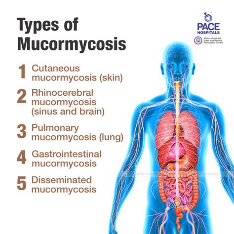 Black Fungus Infection Mucormycosis Disease: Symptoms & Treatment