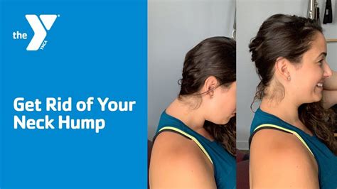Get Rid of Your Neck Hump - YouTube | Neck hump, Neck exercises, Posture neck