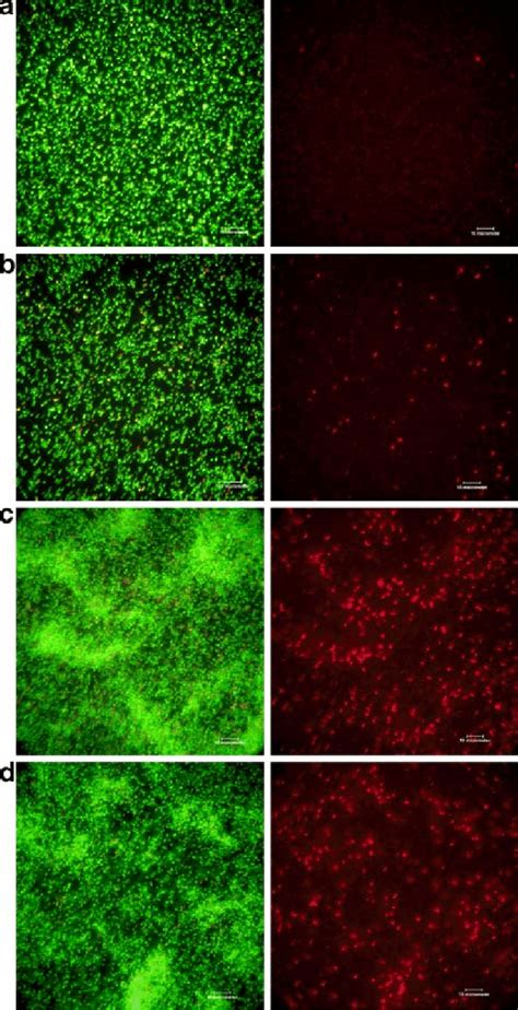 Fluorescence microscopy of E. coli (a, b, c, d) and P. aeruginosa (e ...