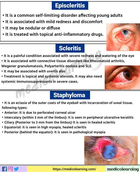 scleritis – MedicoLearning