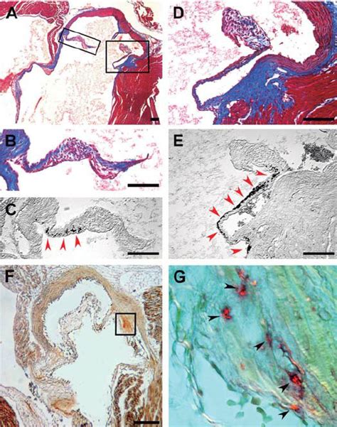 Calcification of the aortic valve leaflets in 6-mo-old Postn Ϫ / Ϫ... | Download Scientific Diagram