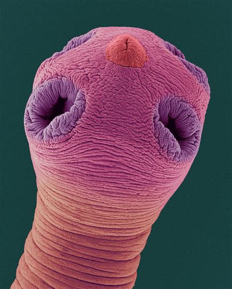 Tapeworm Under A Microscope