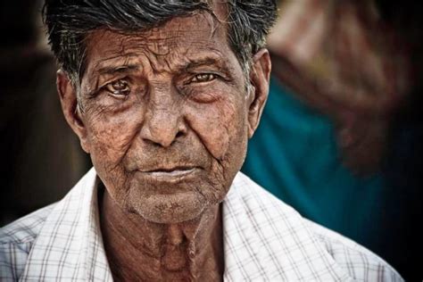 leprosy blog 2 - Embrace A Village