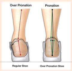 Health, Foot, Heel, Planar Fasciitis, Knee Pain Blog | OrthoFeet ...