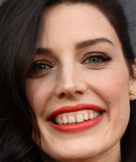 Celebrities With Crooked Teeth: Katy Perry, Rachel Weisz, and More