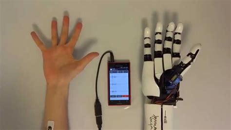 handiii ~accessible myoelectric hand prosthesis~ Japanese young 2 engineers and designer shows ...