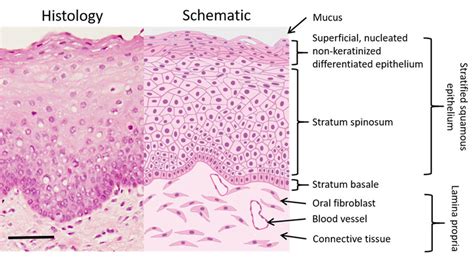 Histological (left) and schematic (right) image of the buccal oral ...