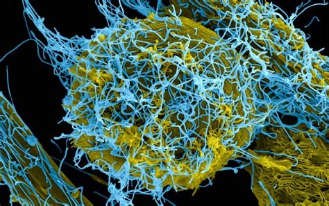 Ebola Vaccine Approved in Europe in Landmark Moment - Scientific American