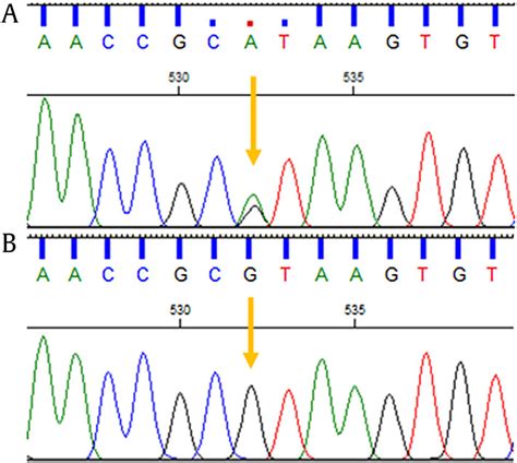 The Sanger sequencing electropherograms. Proband with heterozygous... | Download Scientific Diagram