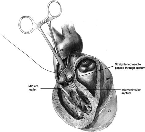 Interventricular Septum Sheep Heart