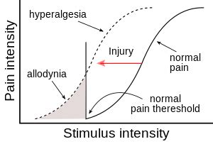 Hyperalgesia - Wikiwand