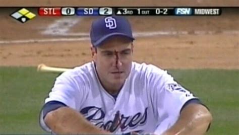 Chris Young, Padres Pitcher, Hit In The Face By Line Drive (VIDEO) | HuffPost Latest News