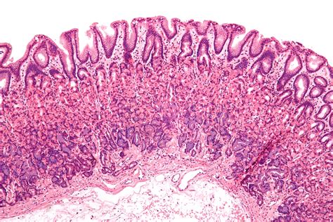 Histology - Stomach - Gastric Portion H&e Stain, Histology Slides, Advanced Learning ...