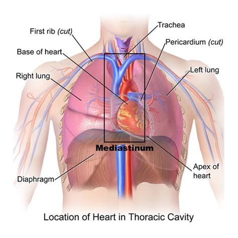 Mediastinal Tumors - Newport Cardiac & Thoracic Surgery