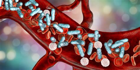 Epic Sepsis Model Poorly Predictive Due to Low Sensitivity, Inadequate Calibration - Infectious ...