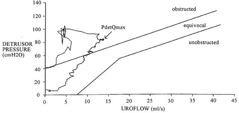 Pressure-flow curve of an illustrative case during voiding. P Q is a... | Download Scientific ...