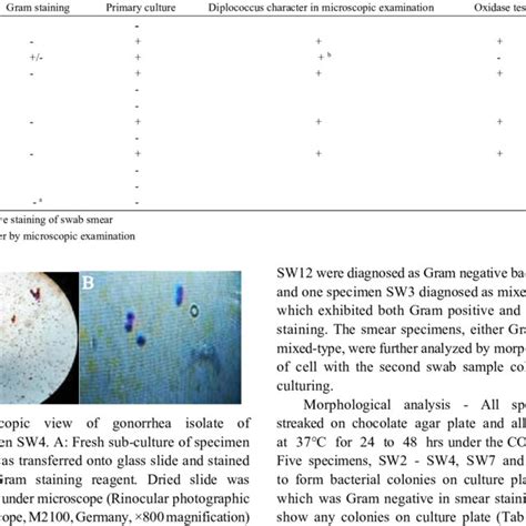 Screening of endocervical swab specimens for N. gonorrhea. | Download Table