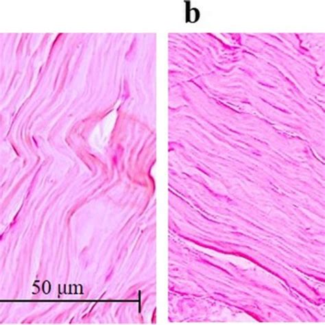 Achilles tendon histology. Hematoxylin and eosin staining of the... | Download Scientific Diagram