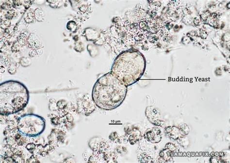 Yeast Under Microscope 1000x