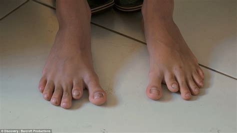 Brazilian family have 12 fingers and toes each | Daily Mail Online