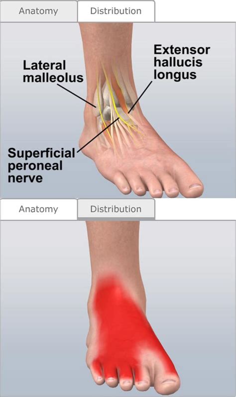 Nerve Blocks of the Lower Extremities - Procedures Consult