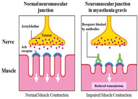 Acetylcholine - Function, Acetylcholine Deficiency, Receptor Antibody