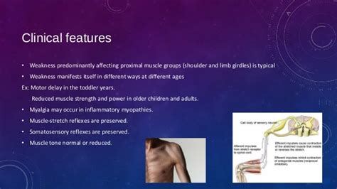 Proximal myopathy and causes