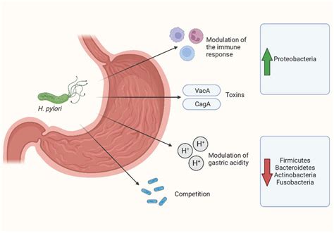 Antibiotics | Free Full-Text | The Influence of Helicobacter pylori on Human Gastric and Gut ...