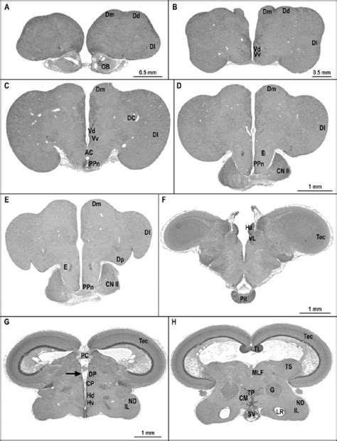 Brain histology (cross sections) of Bovichtus diacanthus from olfactory... | Download Scientific ...