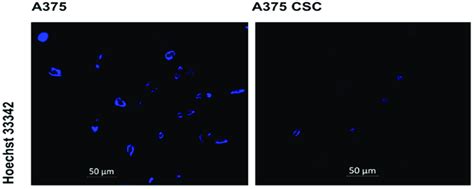 Nuclear stain with the Hoechst 33342 dye, and fluorescence microscopy... | Download Scientific ...