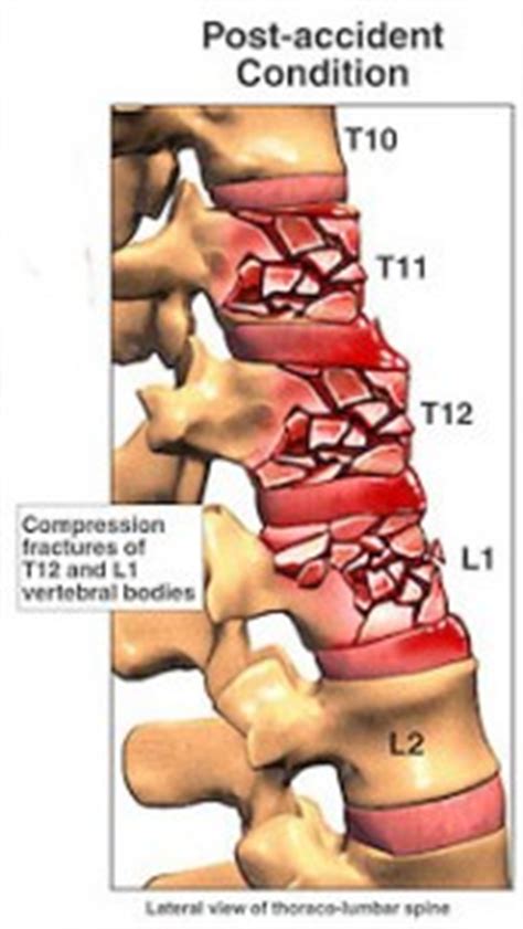 Healing From Spinal Injury | Yoga with Manja