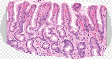 Membrane Histology