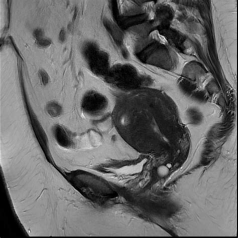 Pelvis MRI - Insight Medical Imaging